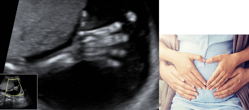 Zakres usług - Diagnostyka prenatalna - Specjalista Ginekolog-Położnik
